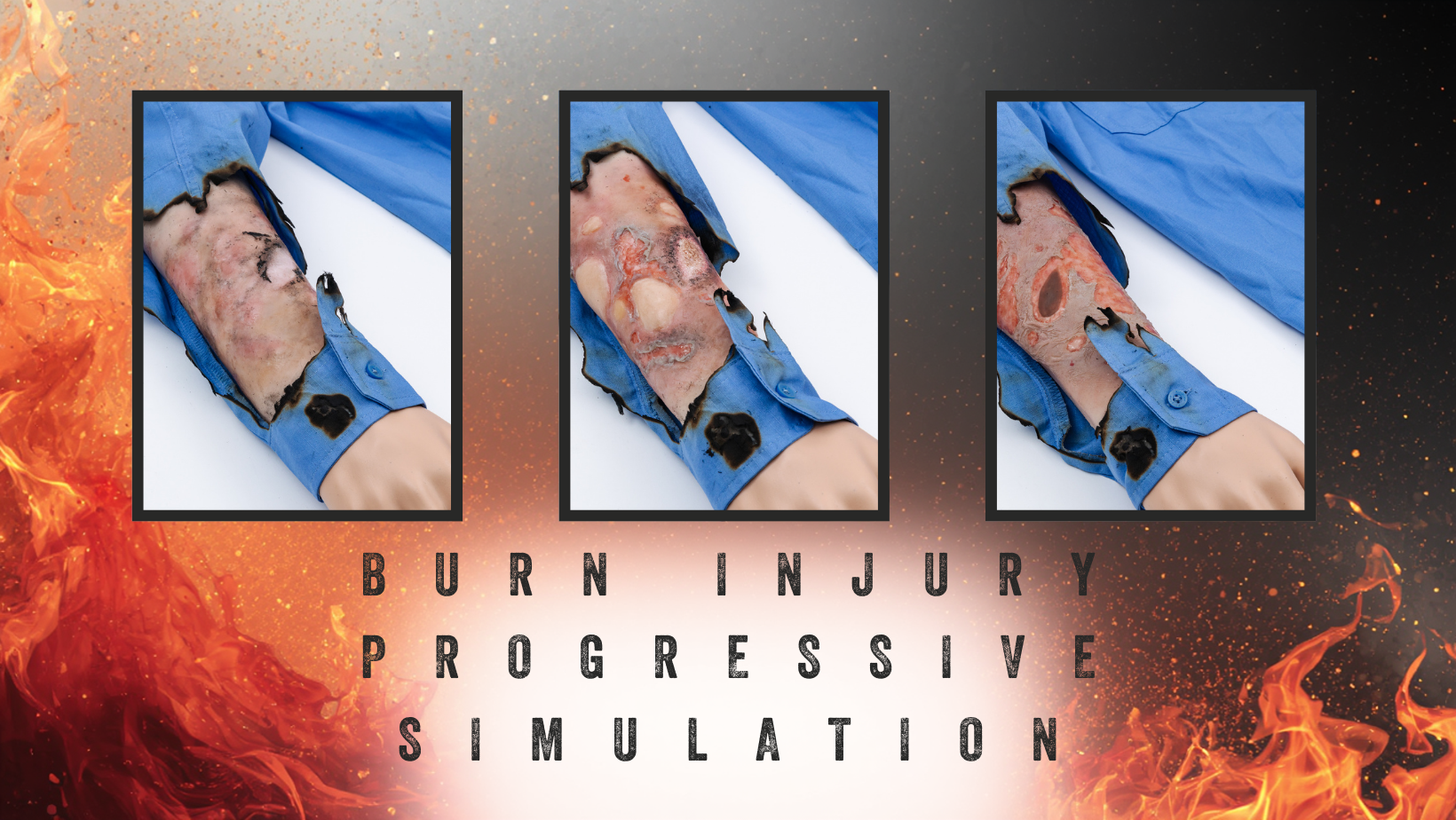 Progressive burn injury simulation training showing staged burn moulage used in TraumaSim emergency responder training