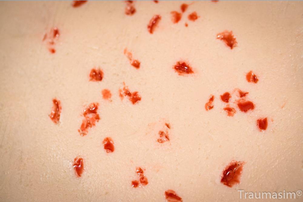 Fragmentation Spray 3 - Image 2