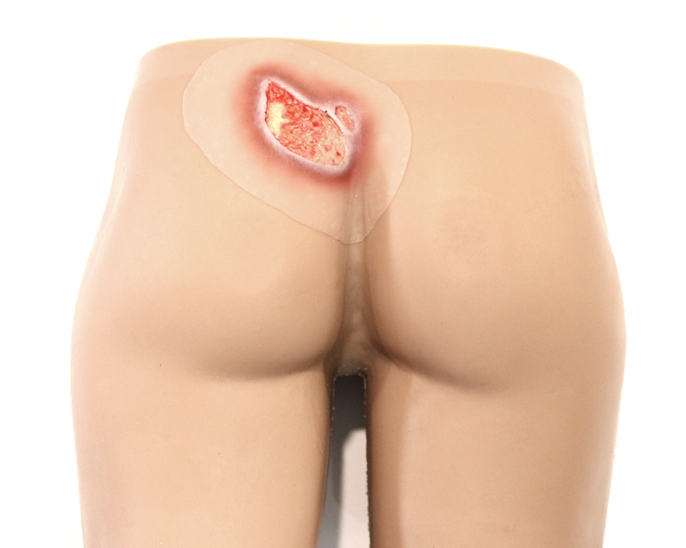 Clinical Pressure Injury Range - Image 6
