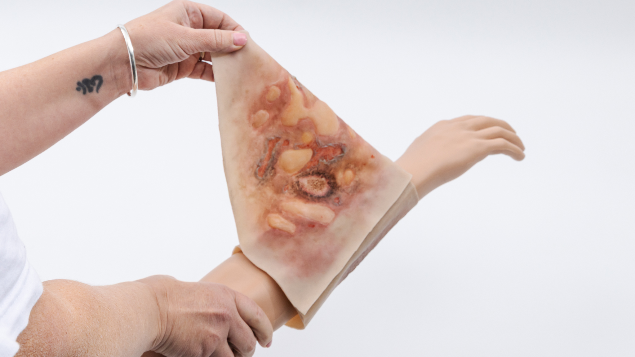Forearm TraumaWear Fire Burn Set - Image 14