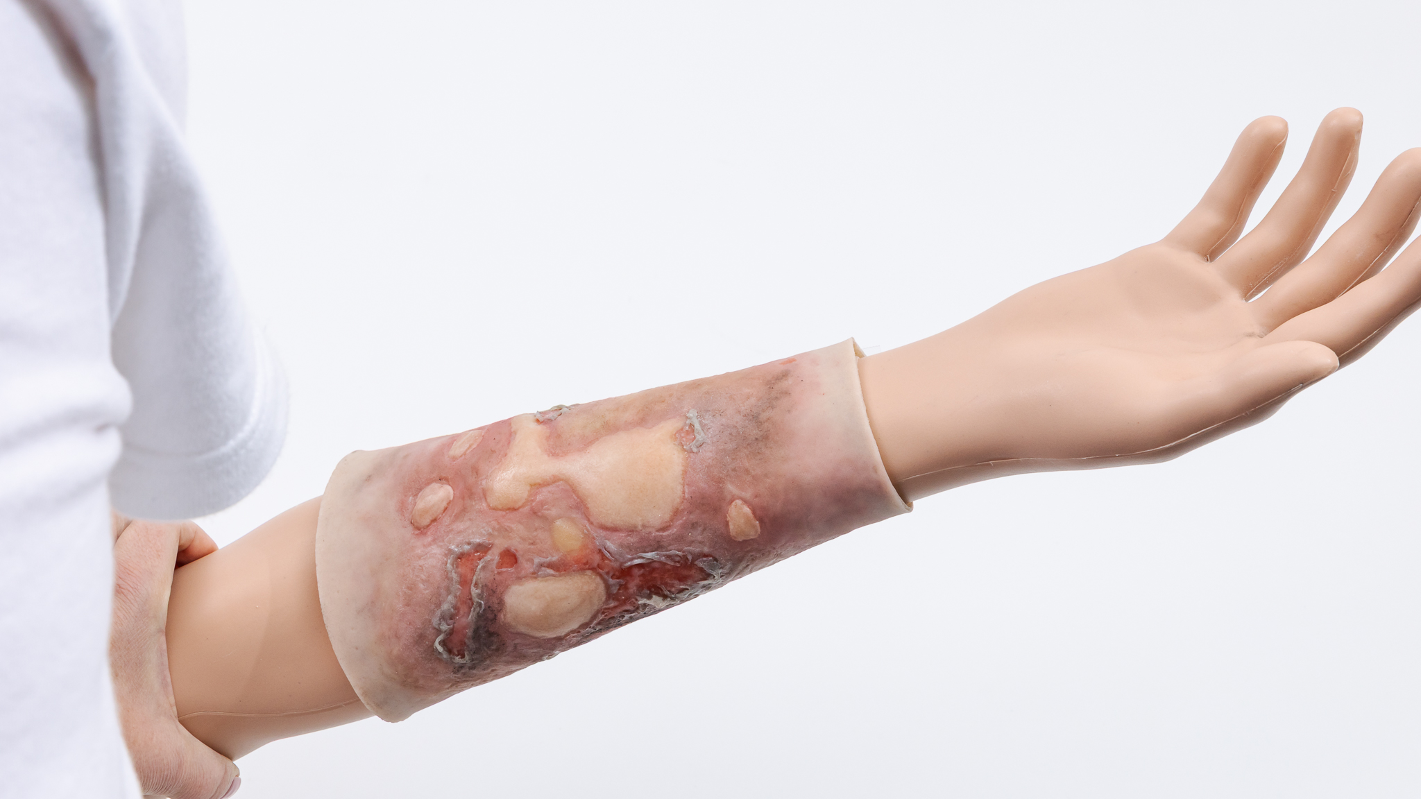 Forearm TraumaWear Fire Burn Set - Image 9