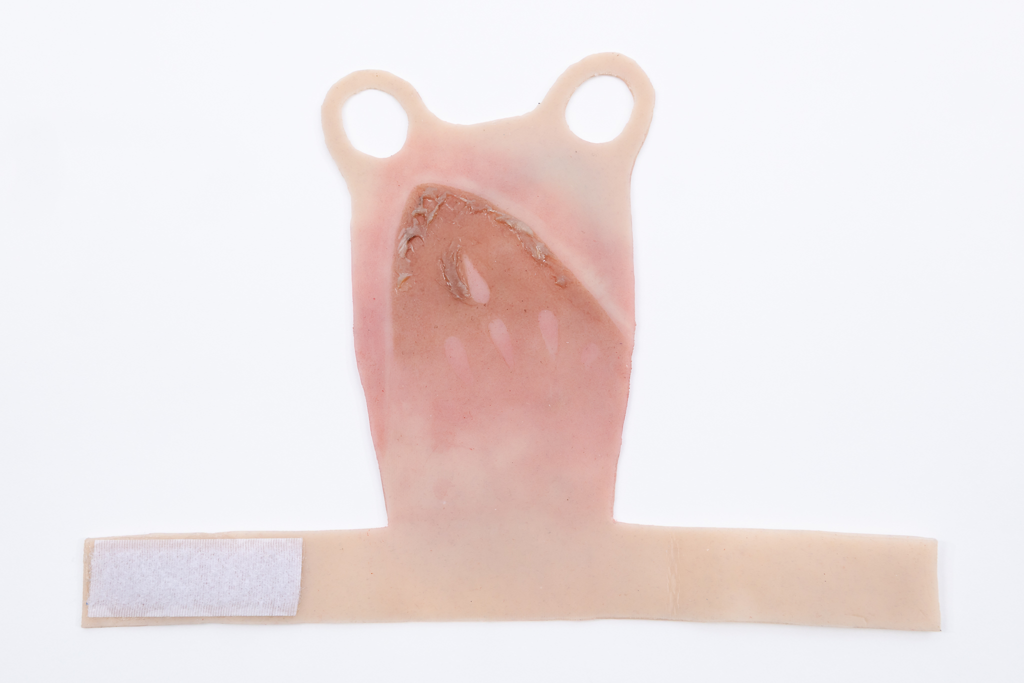 Reversible Hand Contact Burn - Image 7