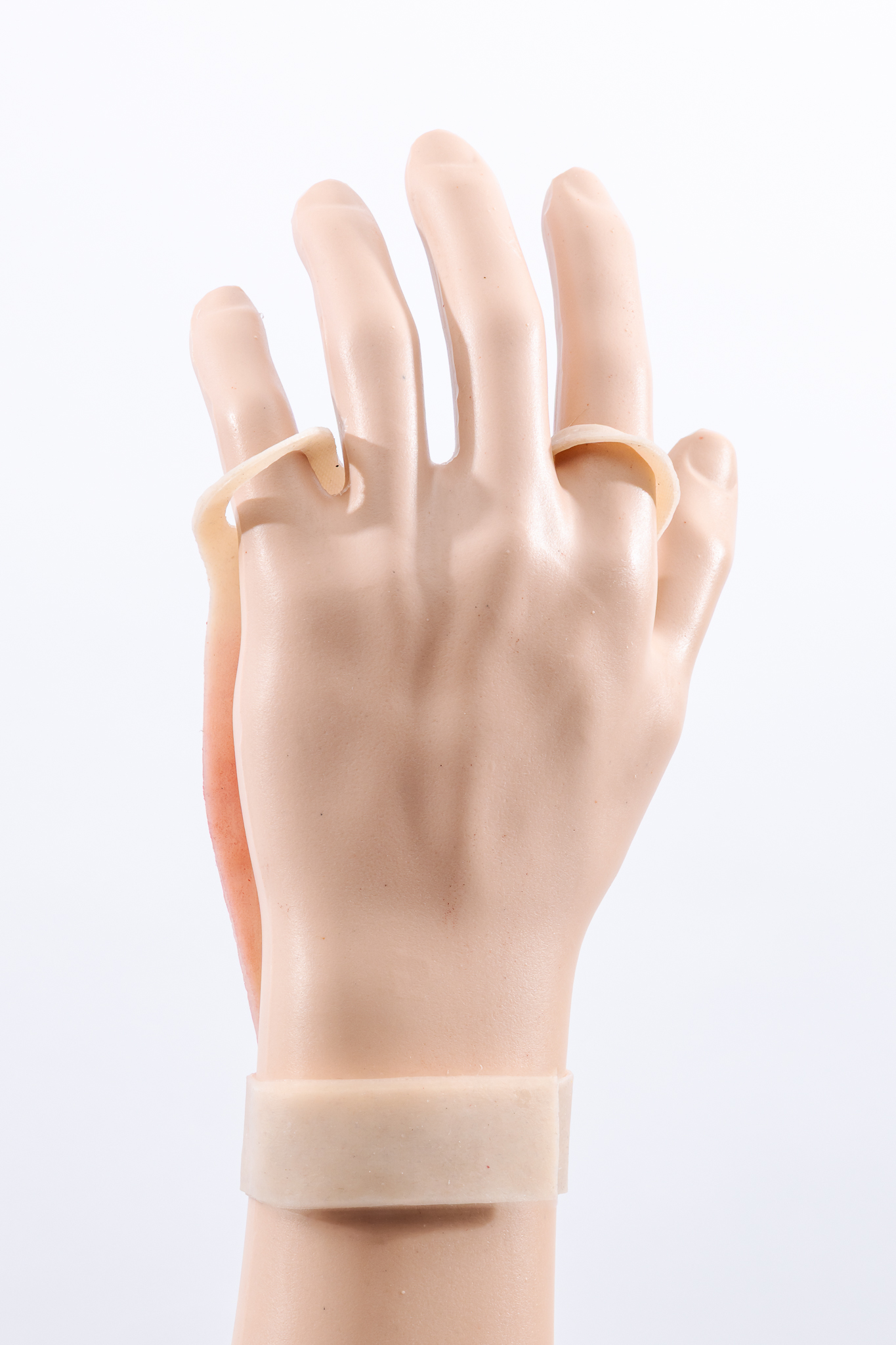 Reversible Hand Contact Burn - Image 2