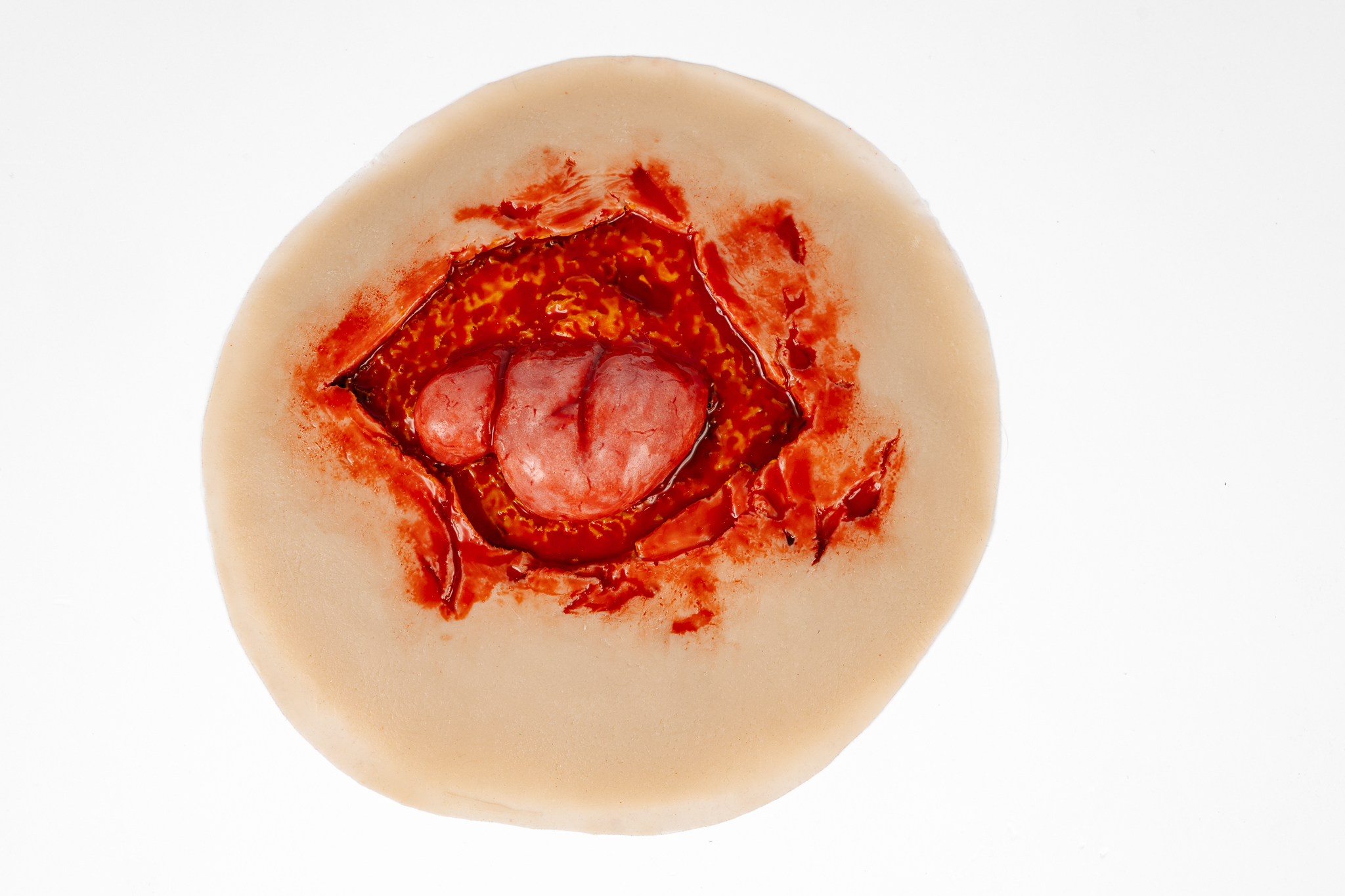 Evisceration with Open Wound - Image 2