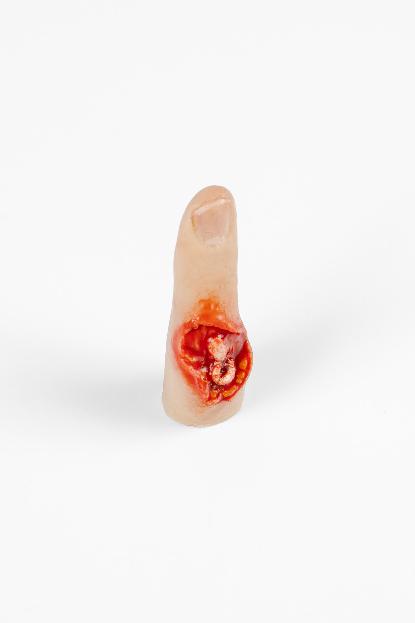 Finger Glove - Exposed Bone Injury - Image 2