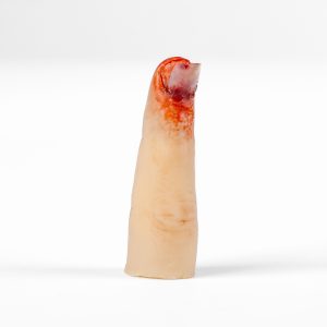 Finger Glove - Nail Bed Injury