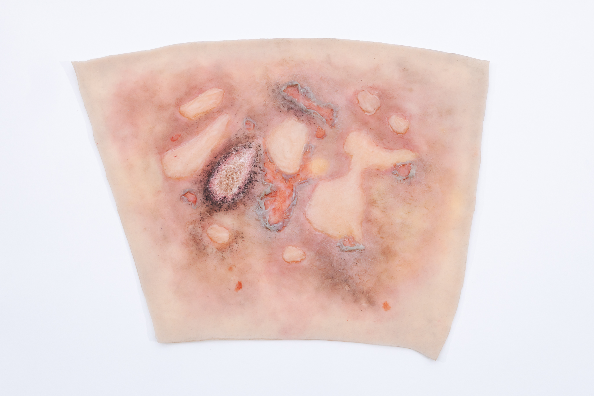 Forearm TraumaWear Fire Burn Set - Image 19