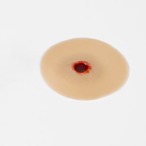Gunshot Wound 7.62mm Entry