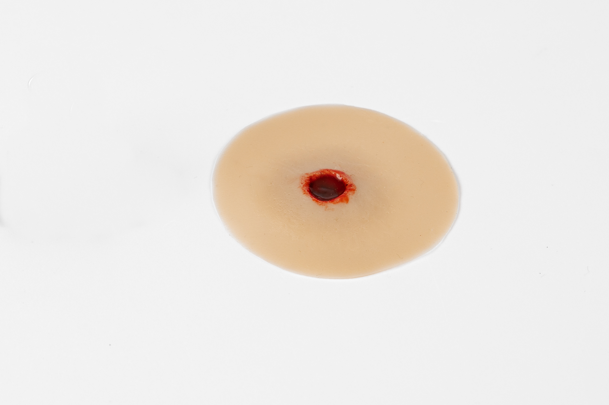 Gunshot Wound 7.62mm Entry