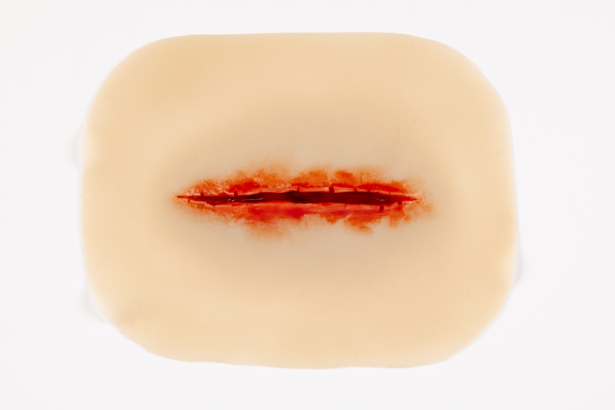 Laceration Suturable - Image 2