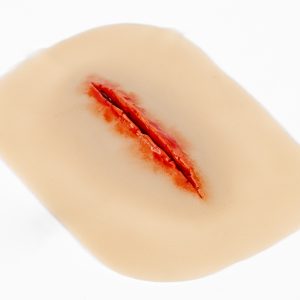 Laceration Suturable