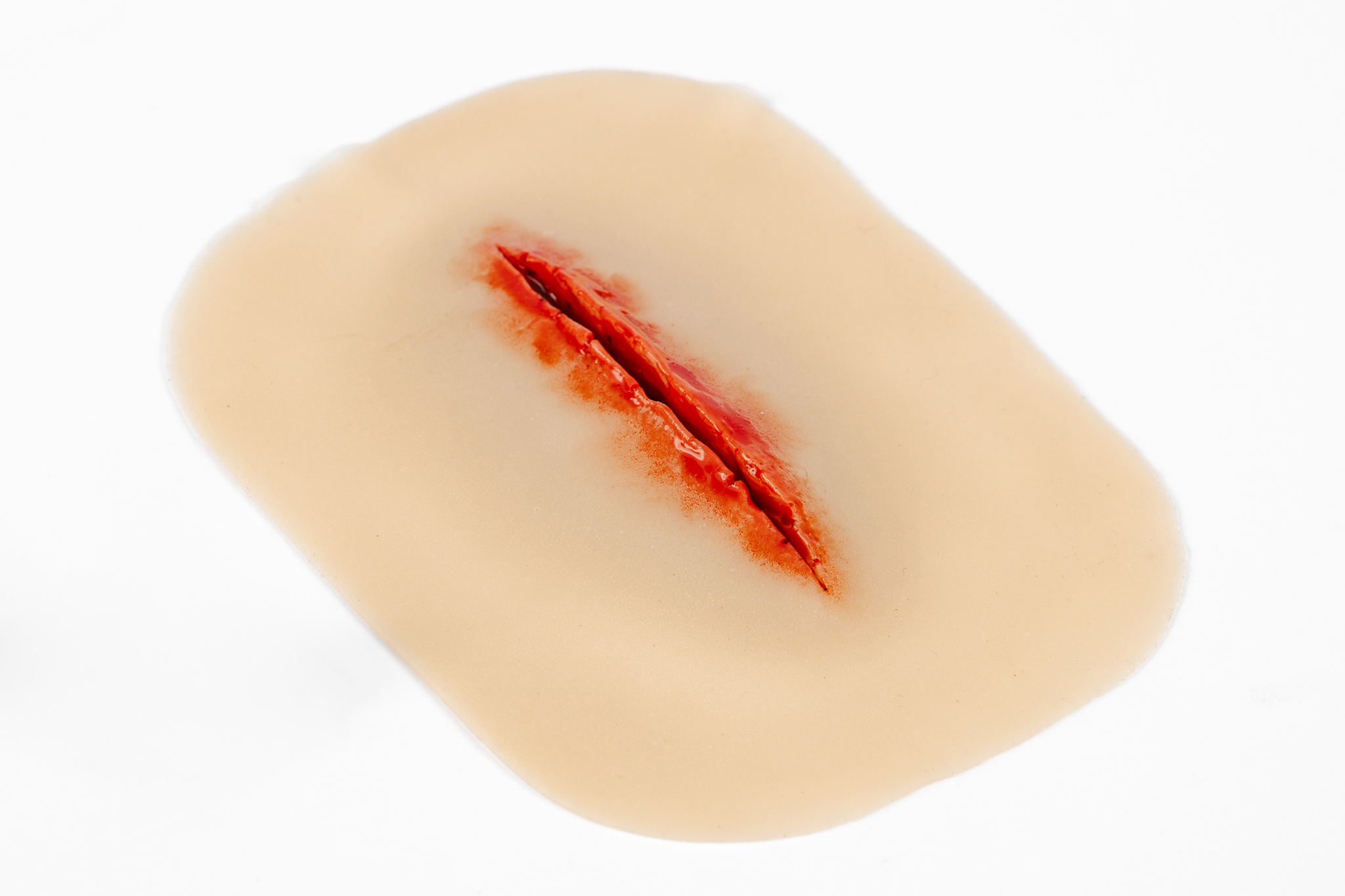 Laceration Suturable