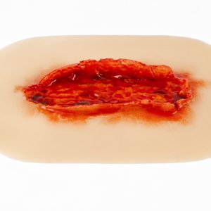 Laceration Open Fat Layer Large