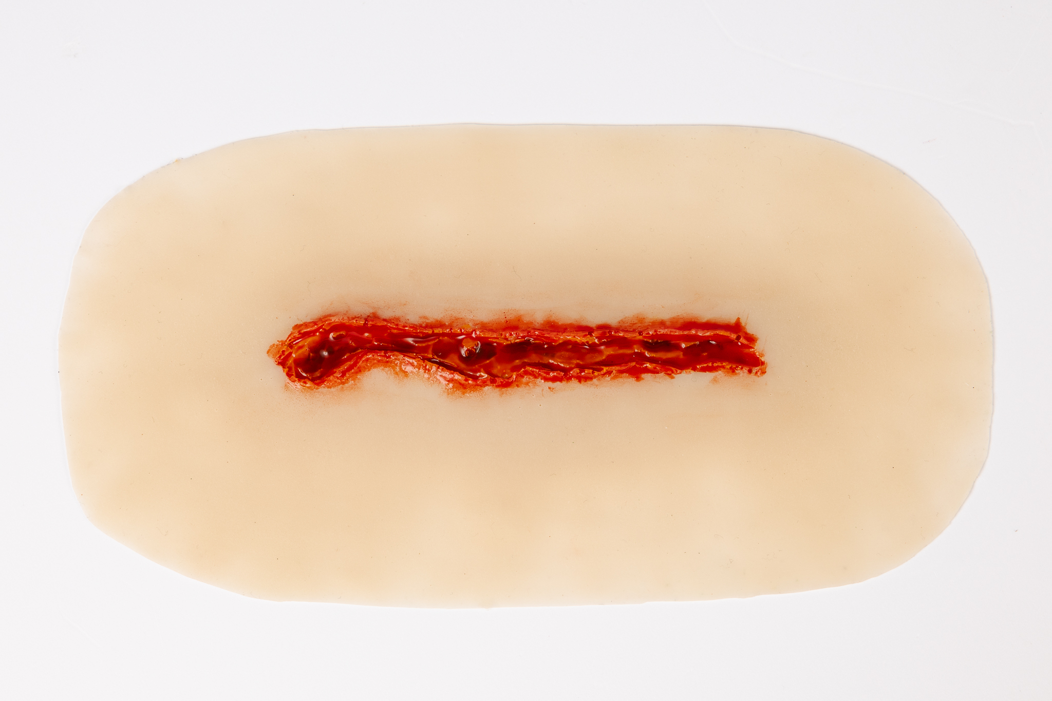 Laceration Elongated