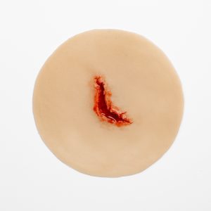 Laceration Jagged 2