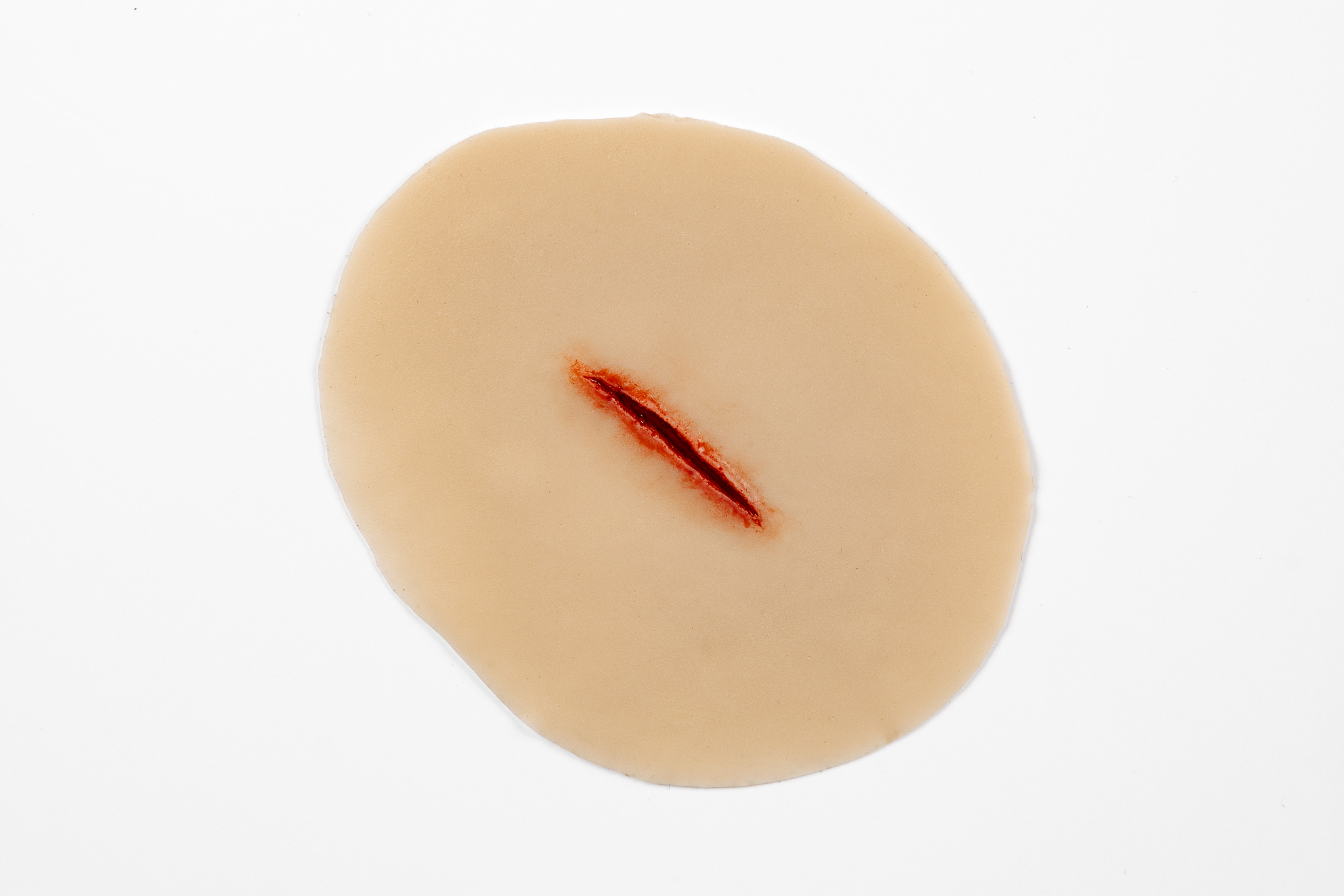 Stab Wound