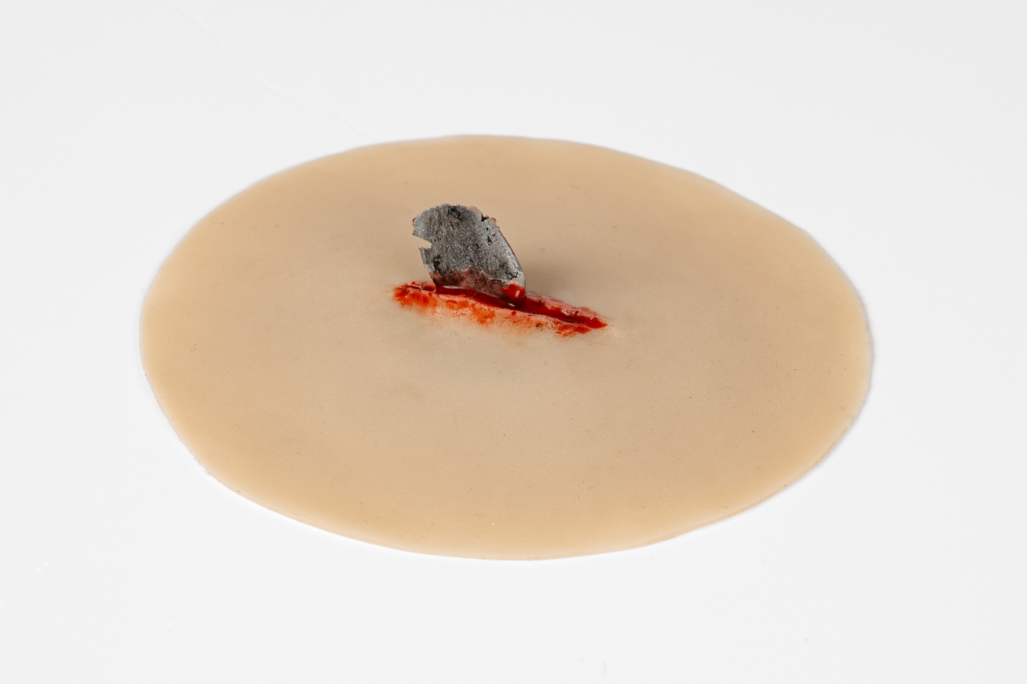 Wound with Metal Fragment