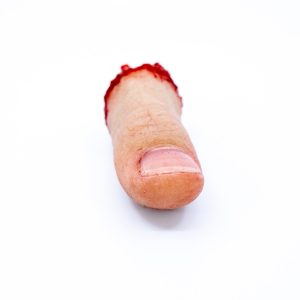 Severed Thumb