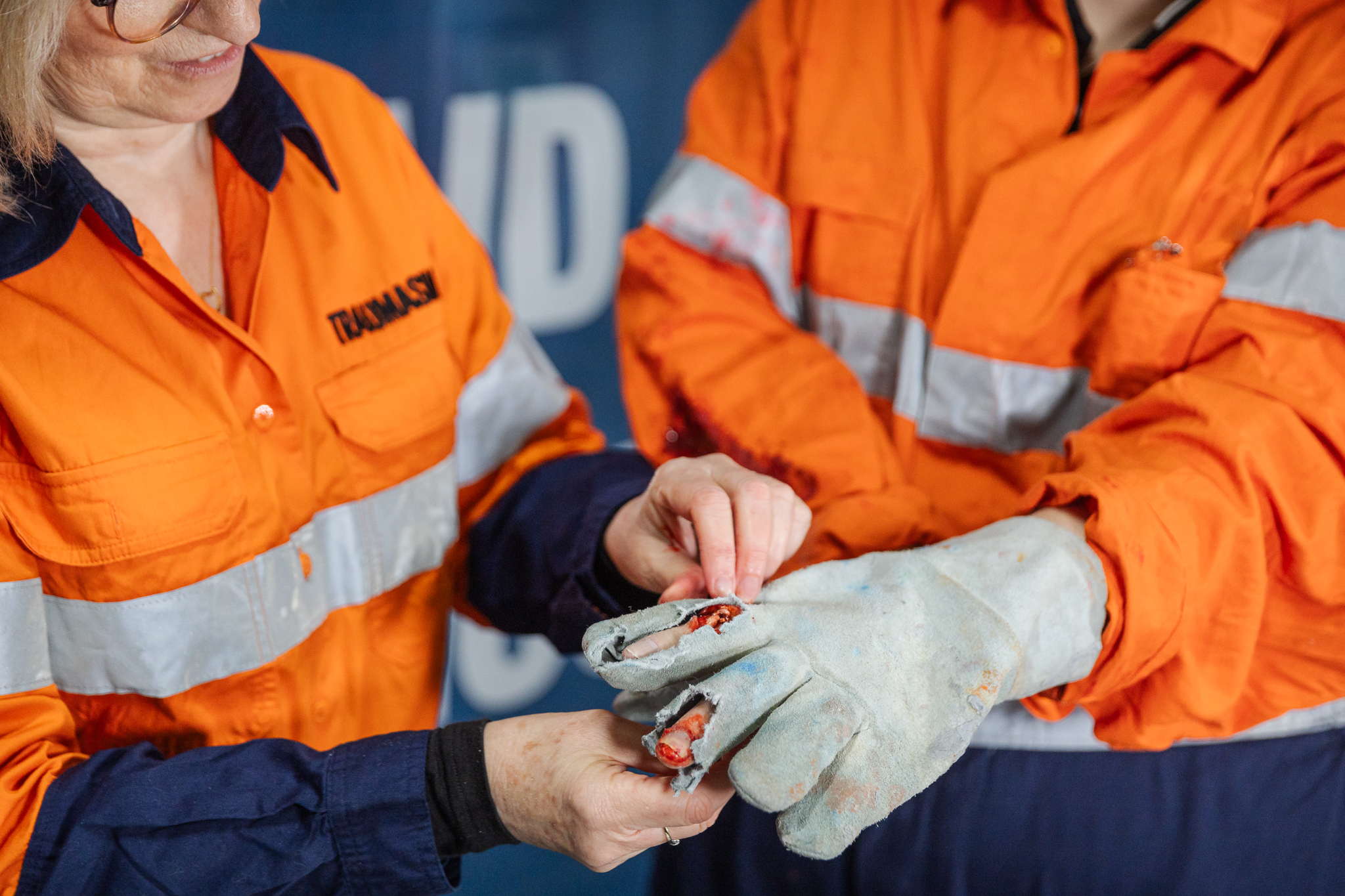 Finger Glove - Exposed Bone Injury - Image 8
