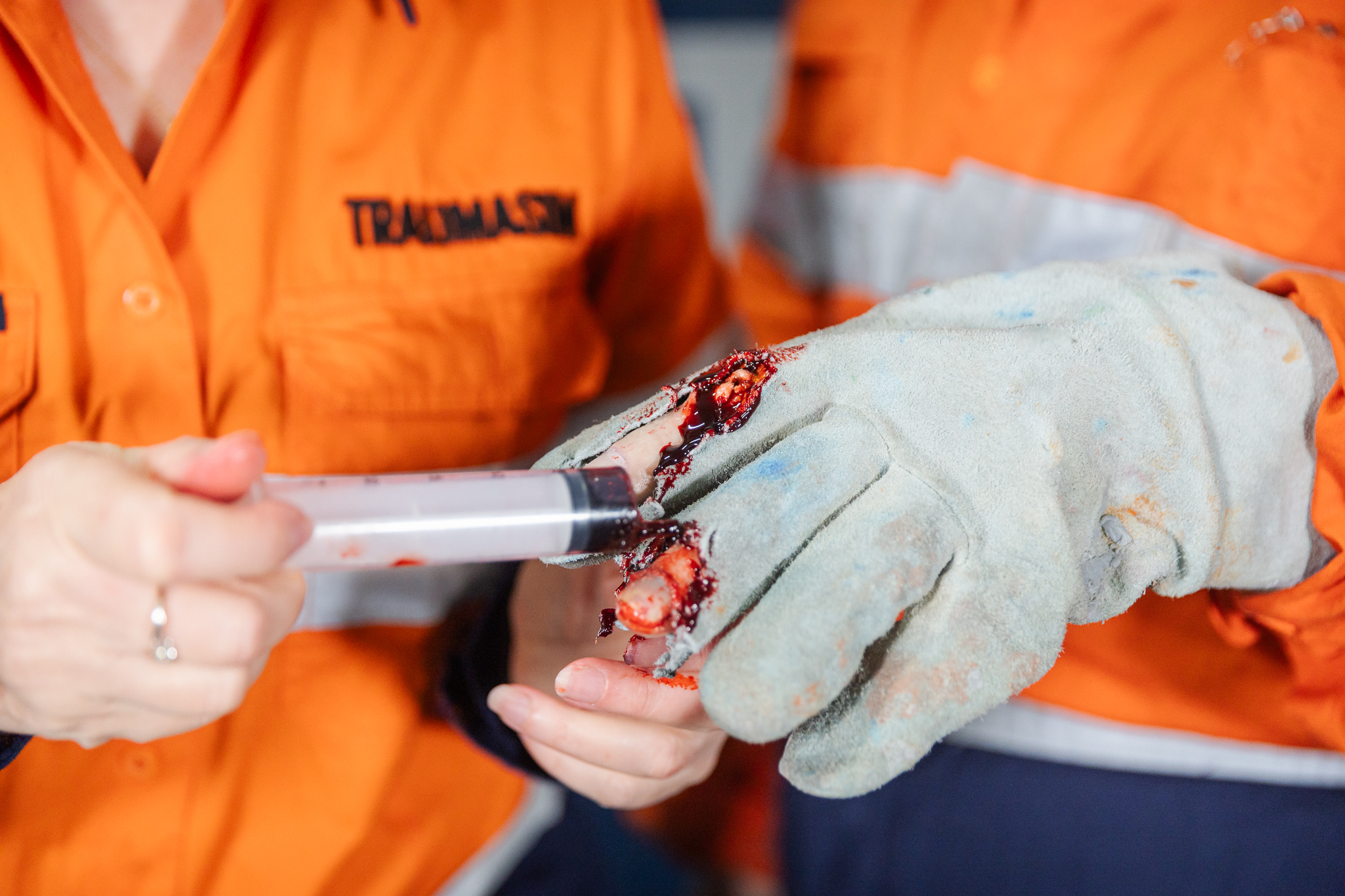 Finger Glove - Exposed Bone Injury - Image 9