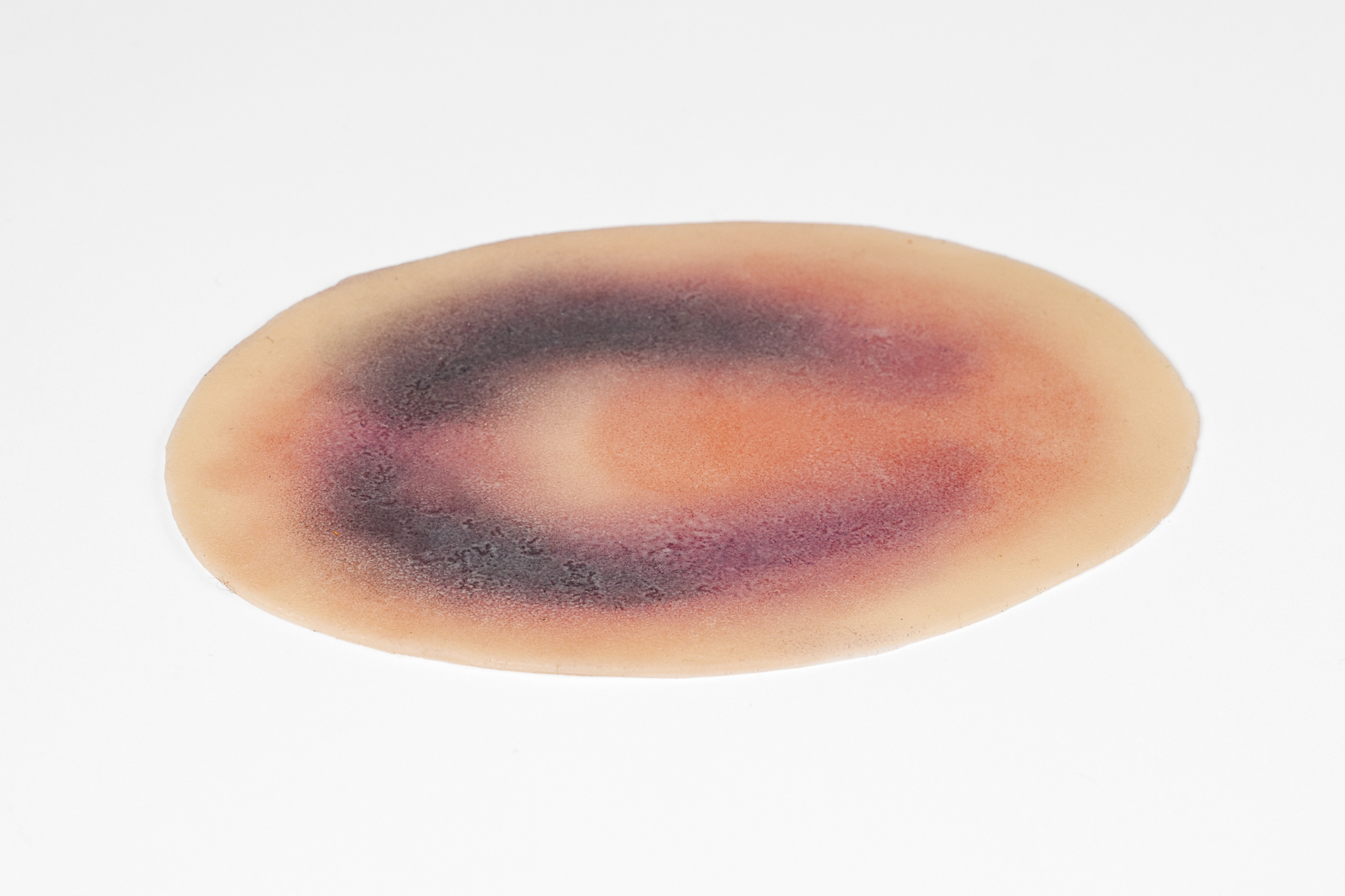 Small Haematoma - Image 2