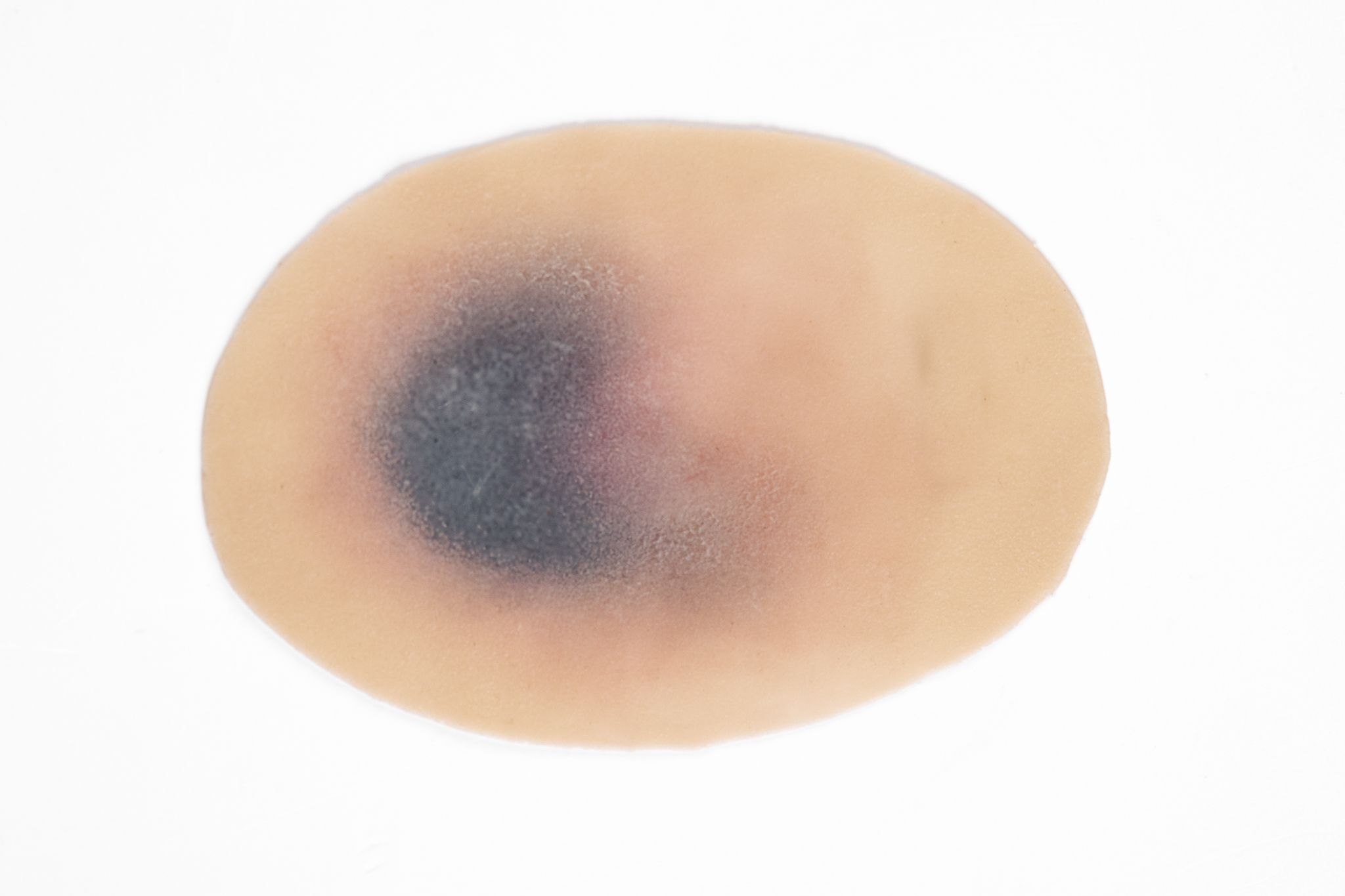 Clinical Pressure Injury Range - Image 12