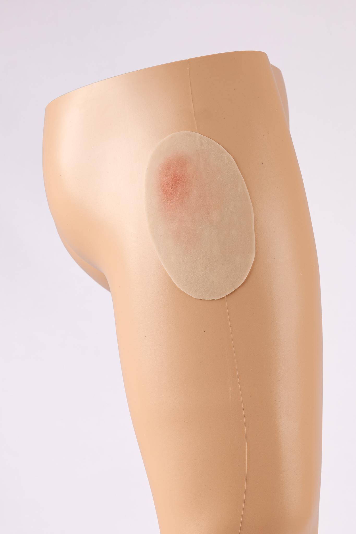 Silicone Wound Kit - Clinical - Image 8