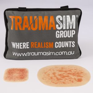 Clinical Rash and Hives Range