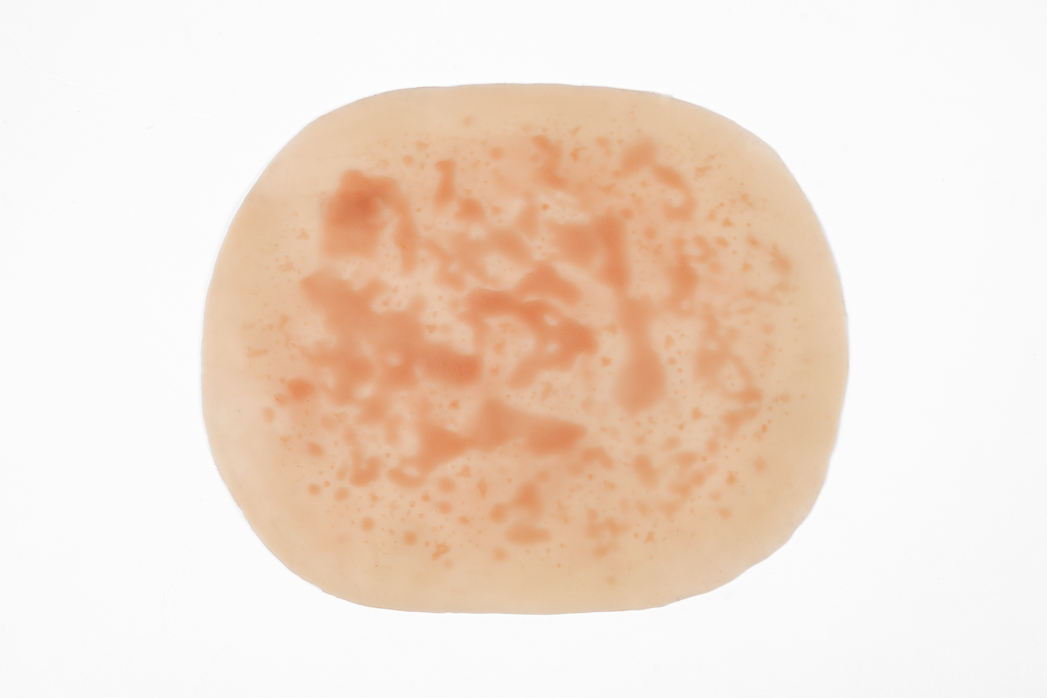 Clinical Rash and Hives Range - Image 5