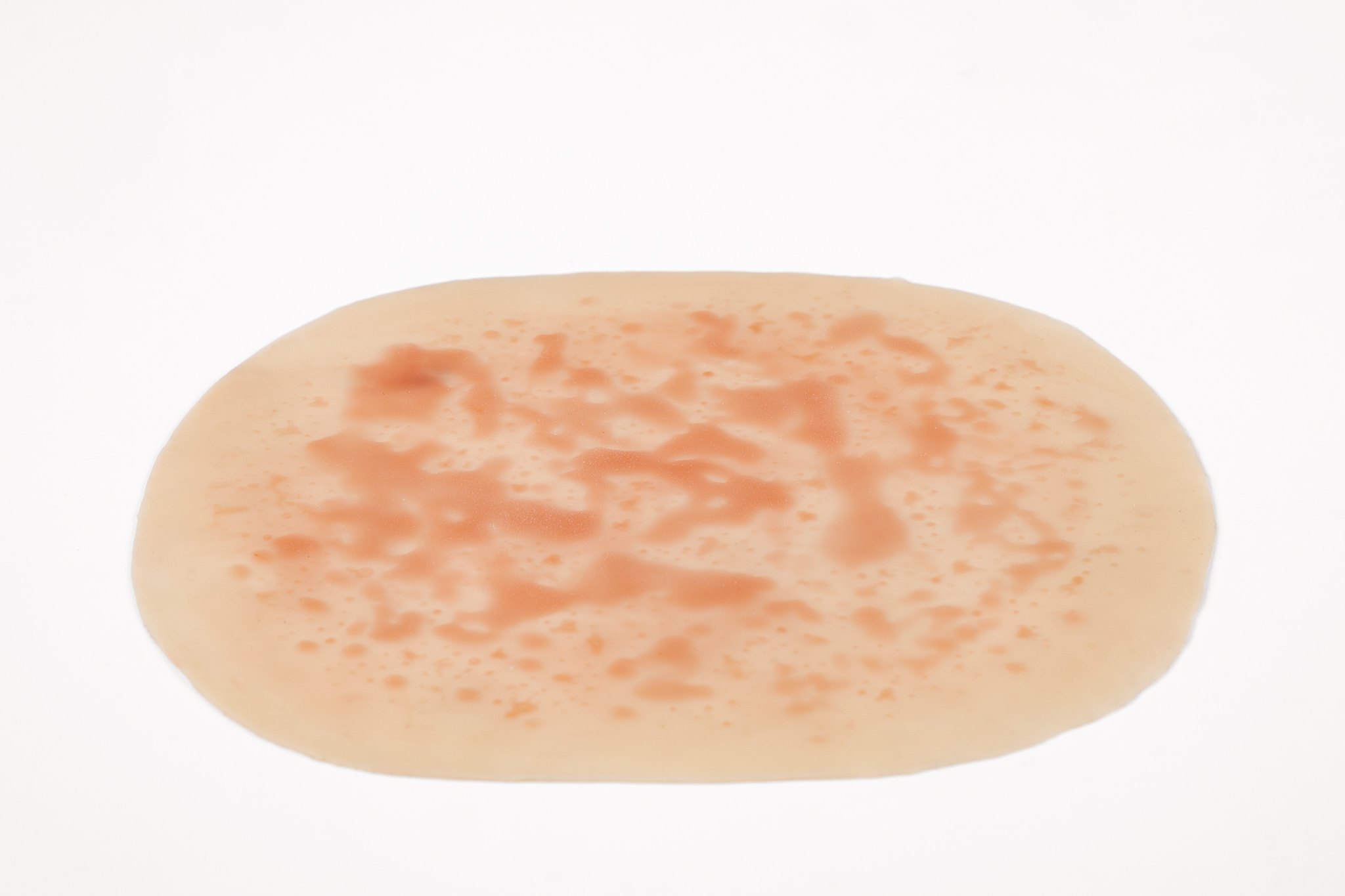 Silicone Wound Kit - Clinical - Image 14