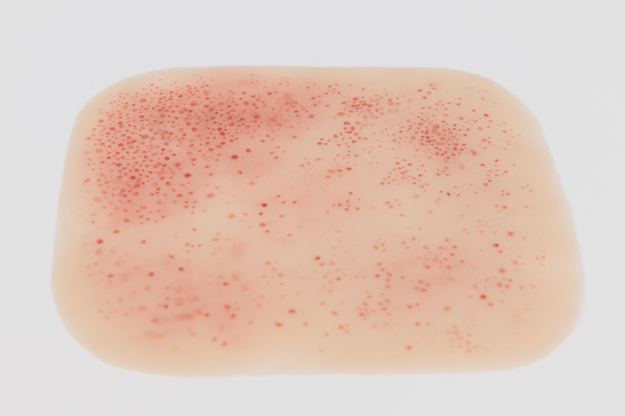 Silicone Wound Kit - Clinical - Image 15