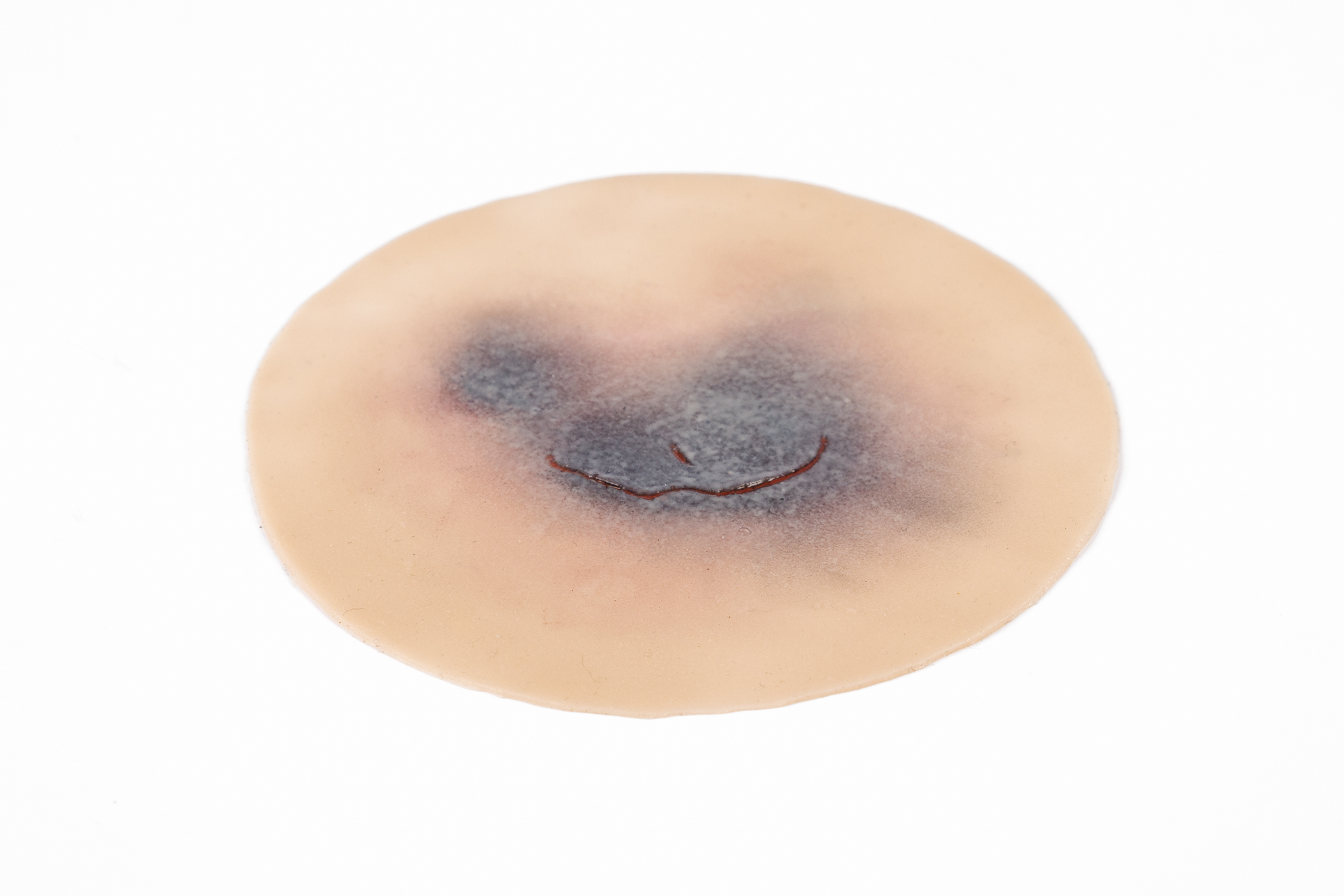 Clinical Skin Tear Range - Image 5