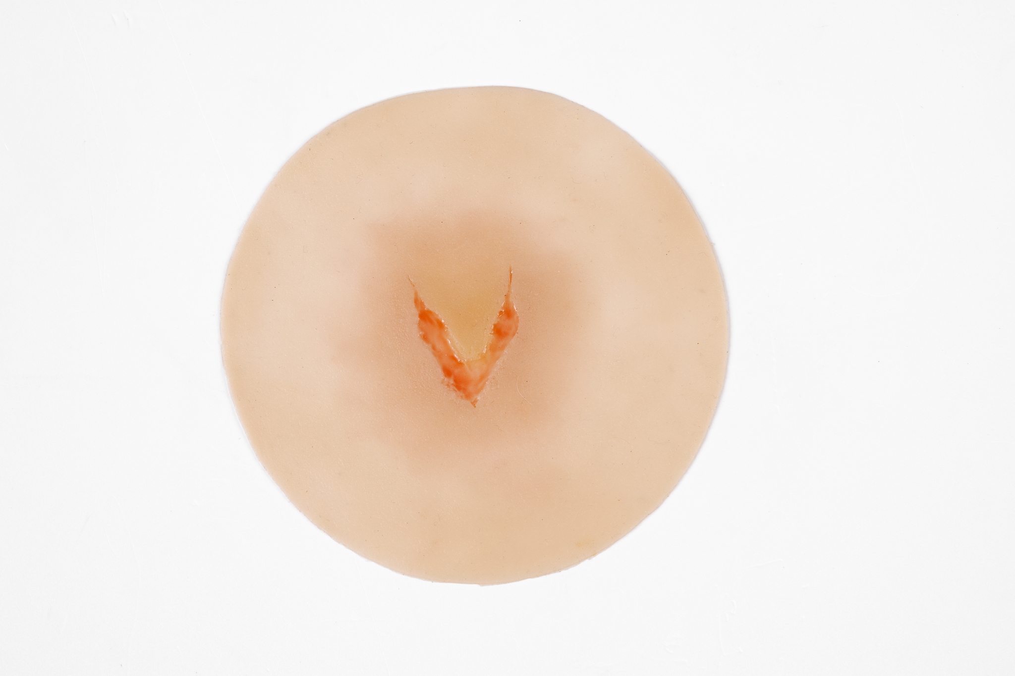 Clinical Skin Tear Range - Image 7