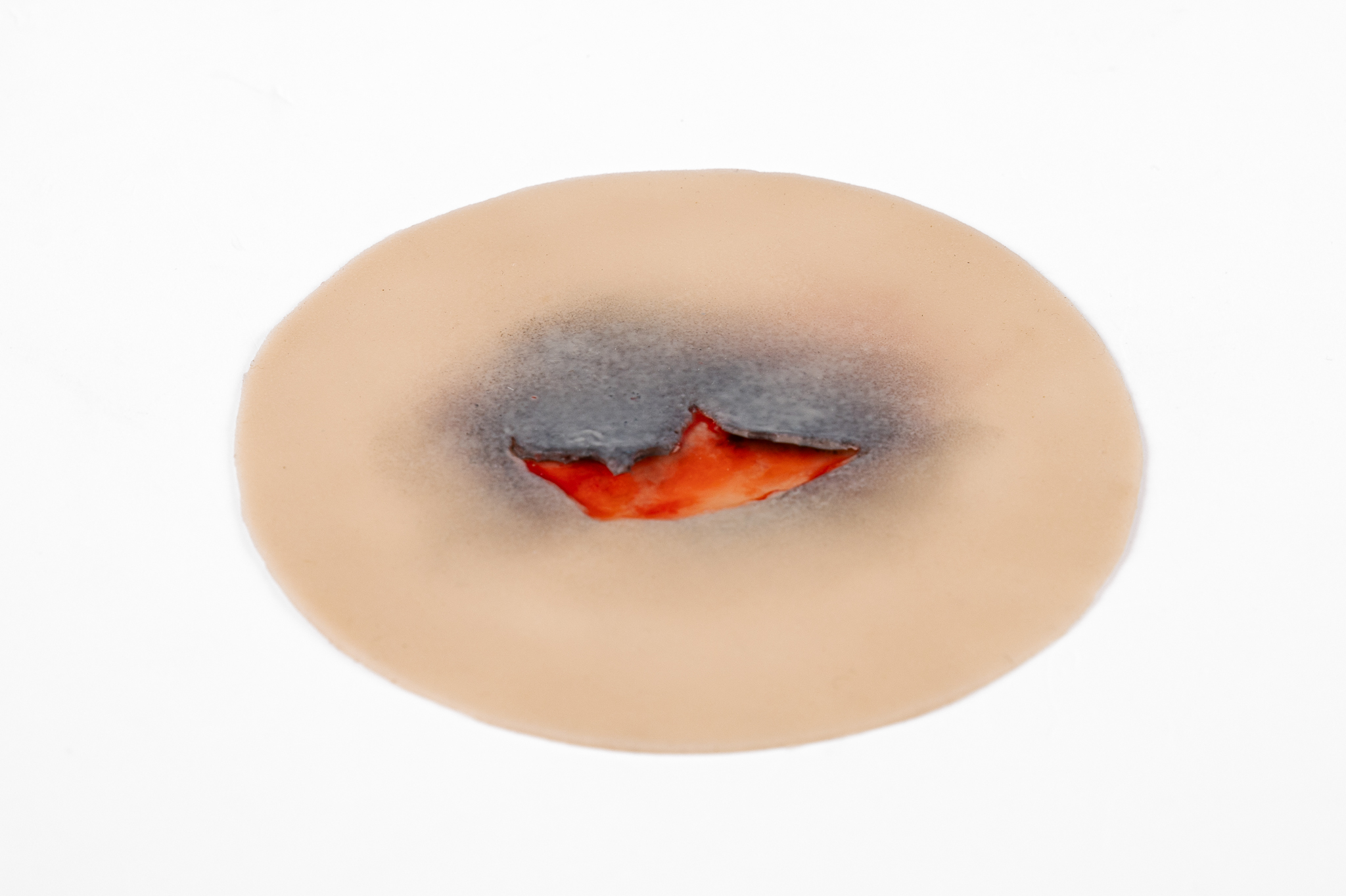 Clinical Skin Tear Range - Image 9