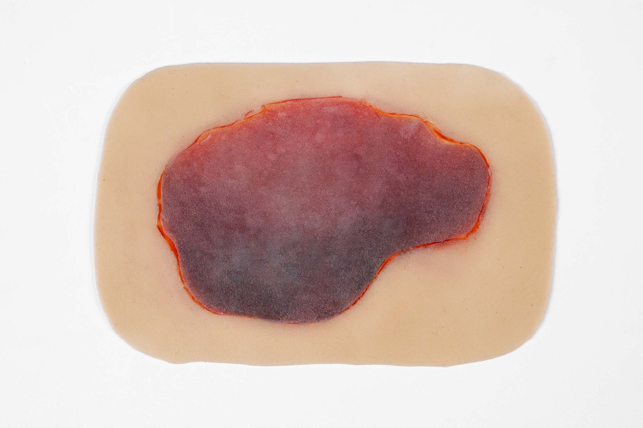 Clinical Skin Tear Range - Image 12