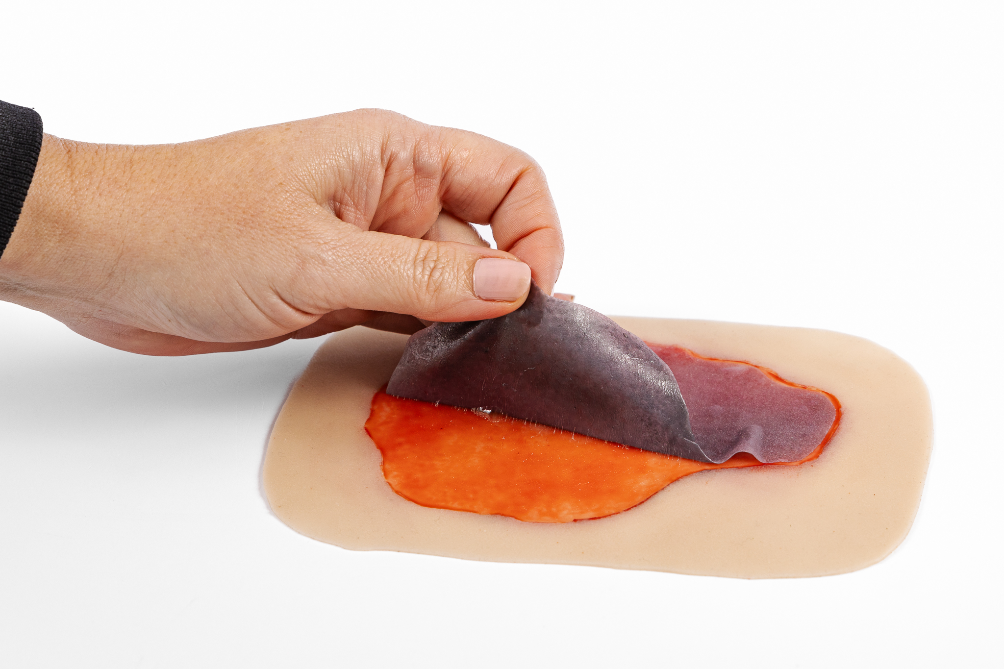 Skin Tear with Mobile Skin - Image 4