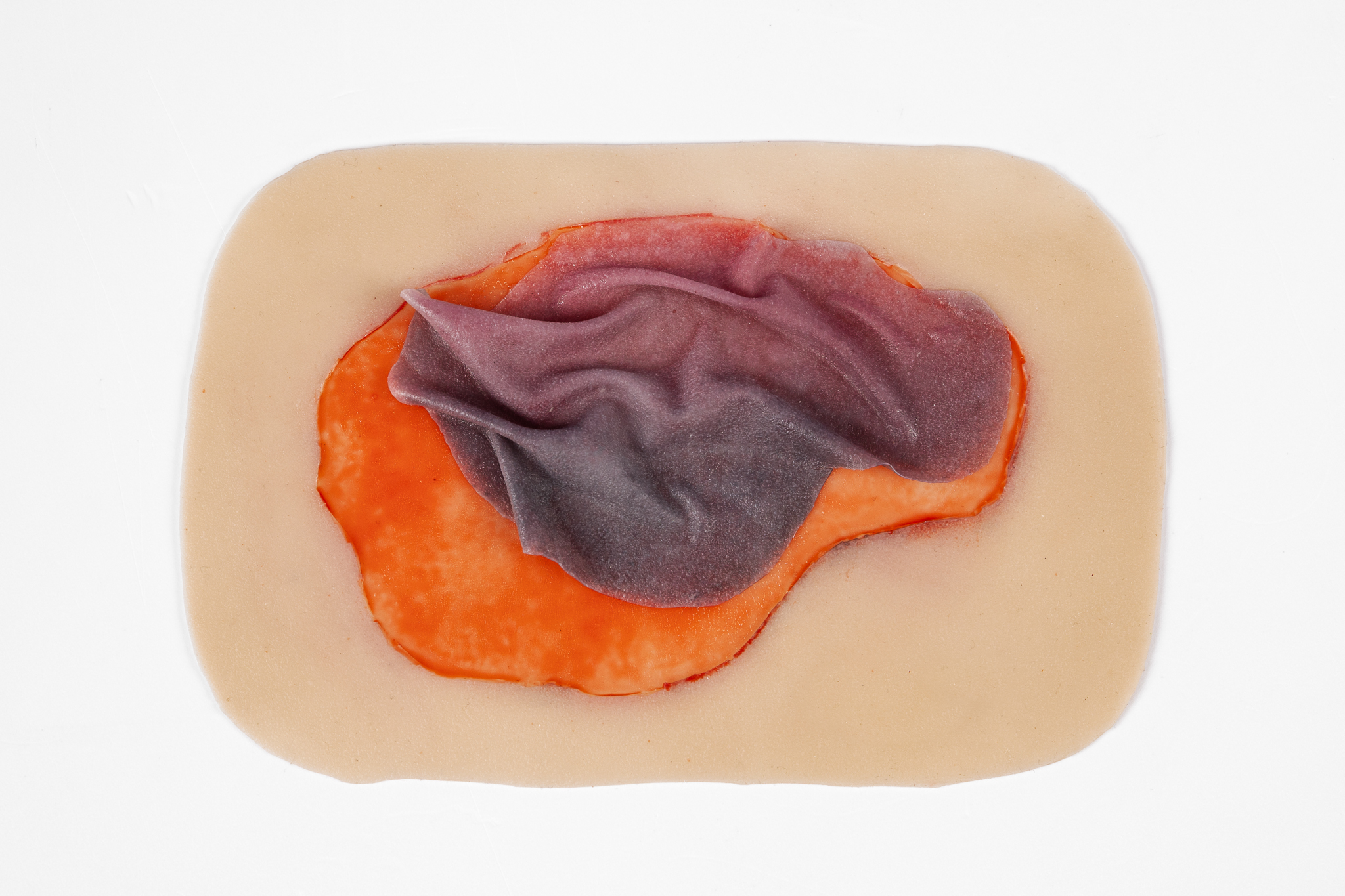 Skin Tear with Mobile Skin - Image 2