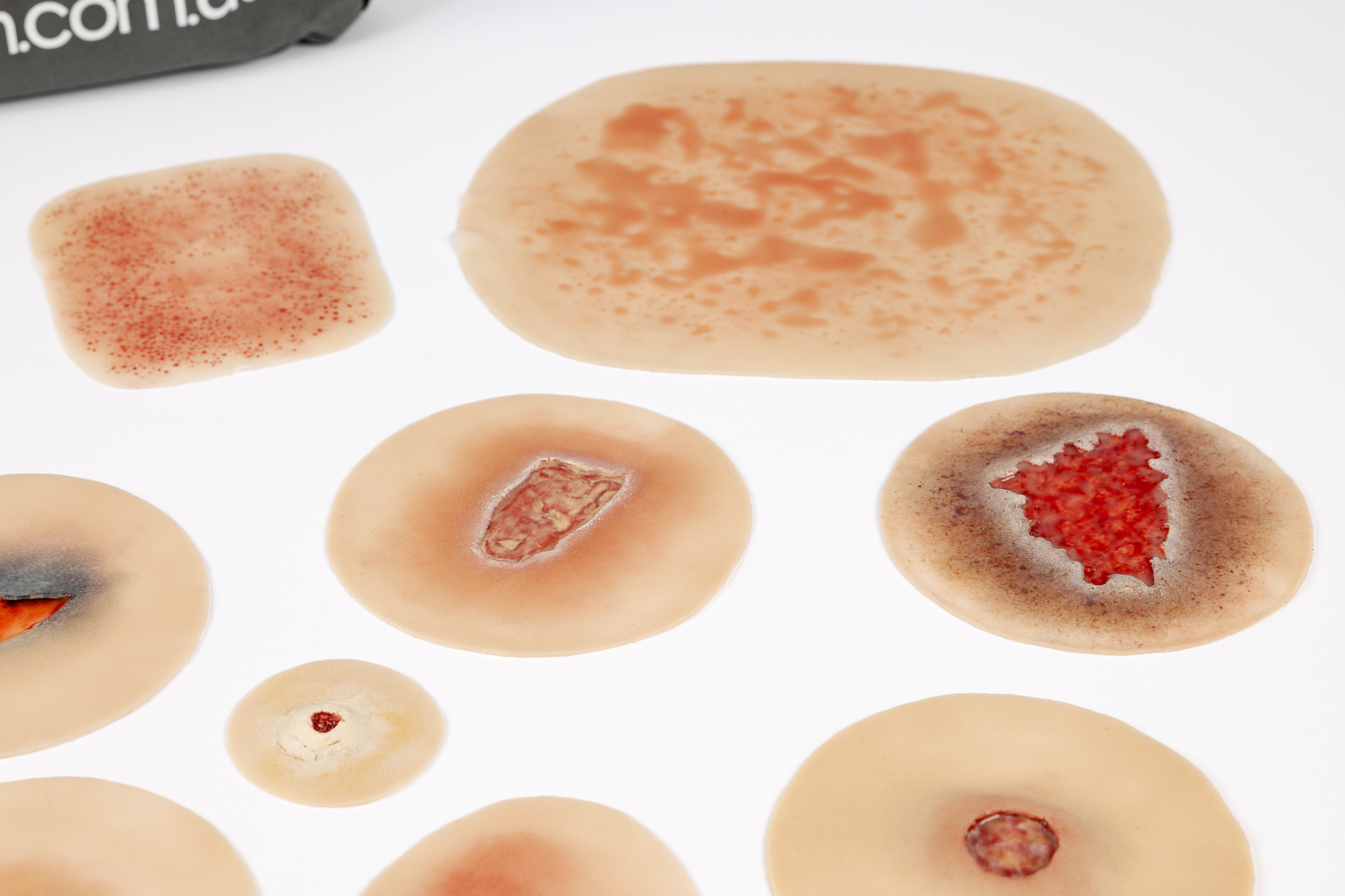 Silicone Wound Kit - Clinical - Image 6
