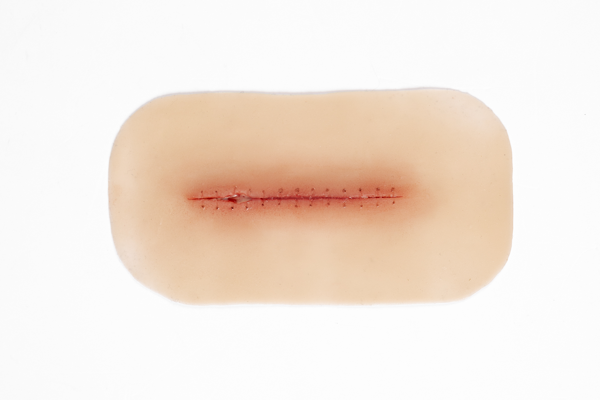 Dehiscence Small - Image 2