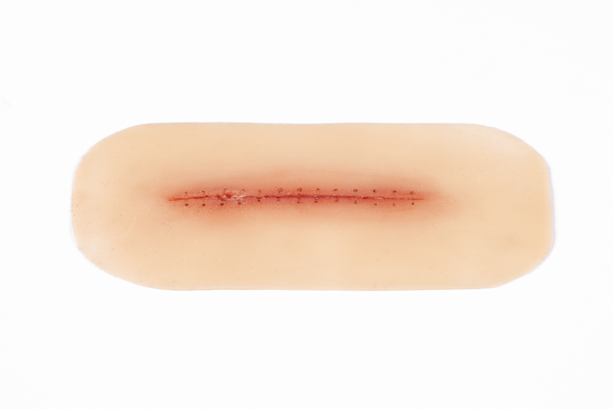 Dehiscence Small