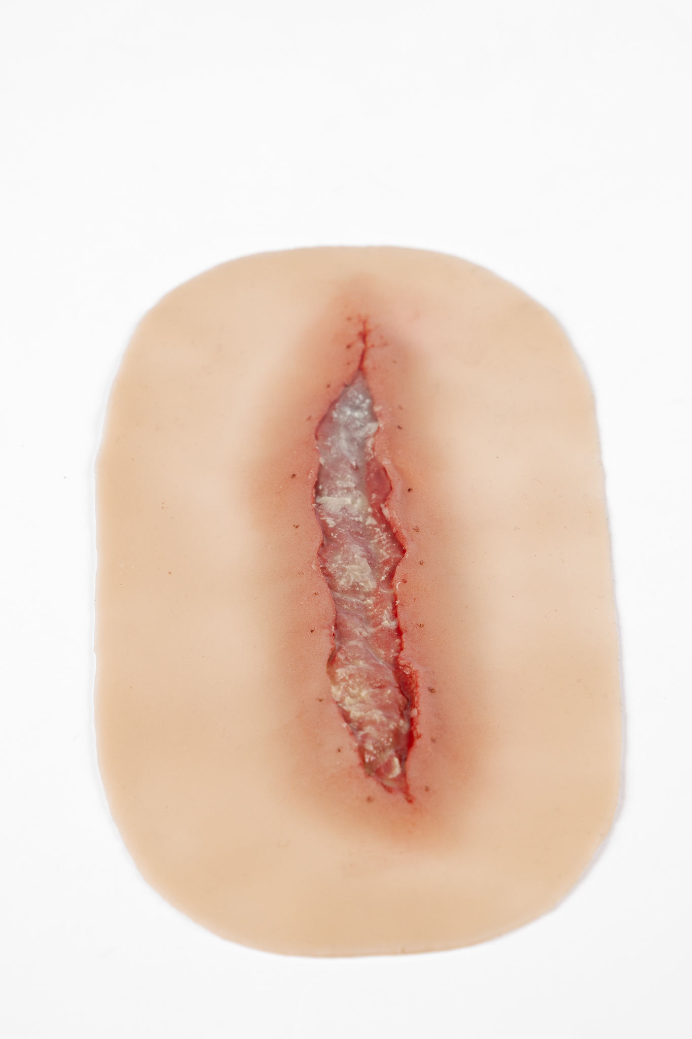 Silicone Wound Kit - Clinical - Image 25