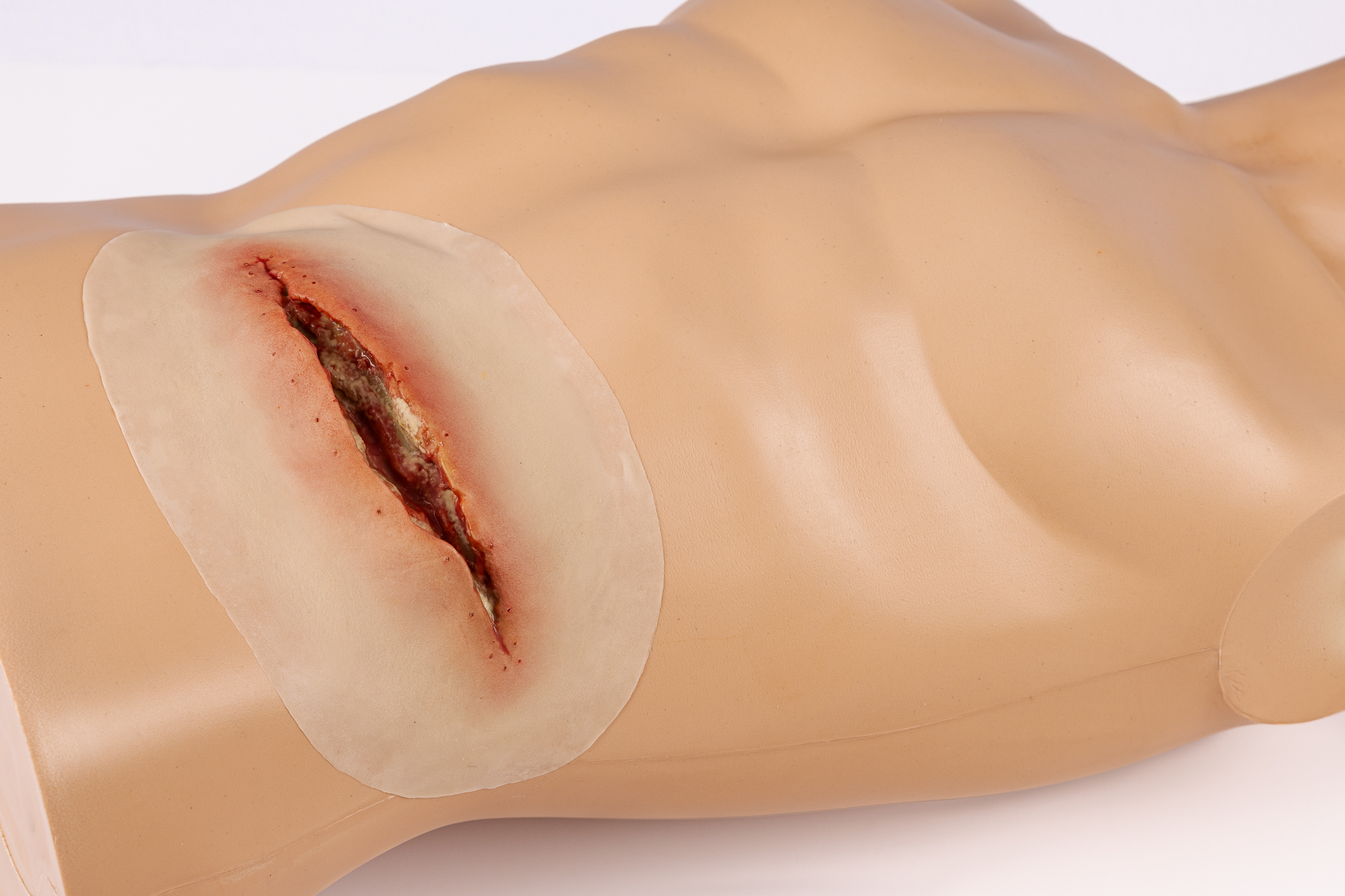 Silicone Wound Kit - Clinical - Image 26