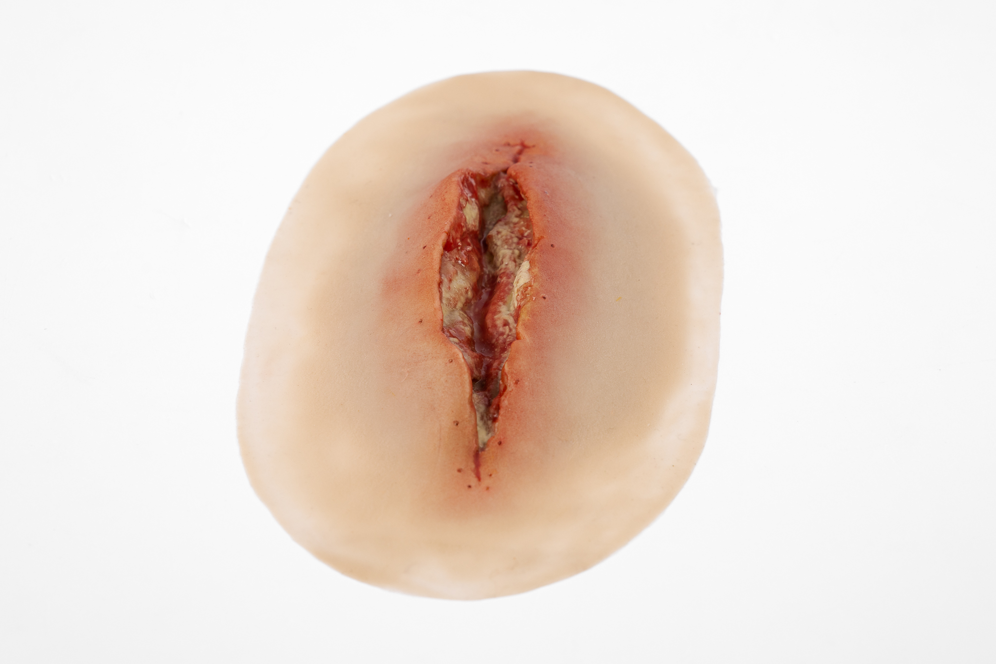 Dehiscence Large - Image 2