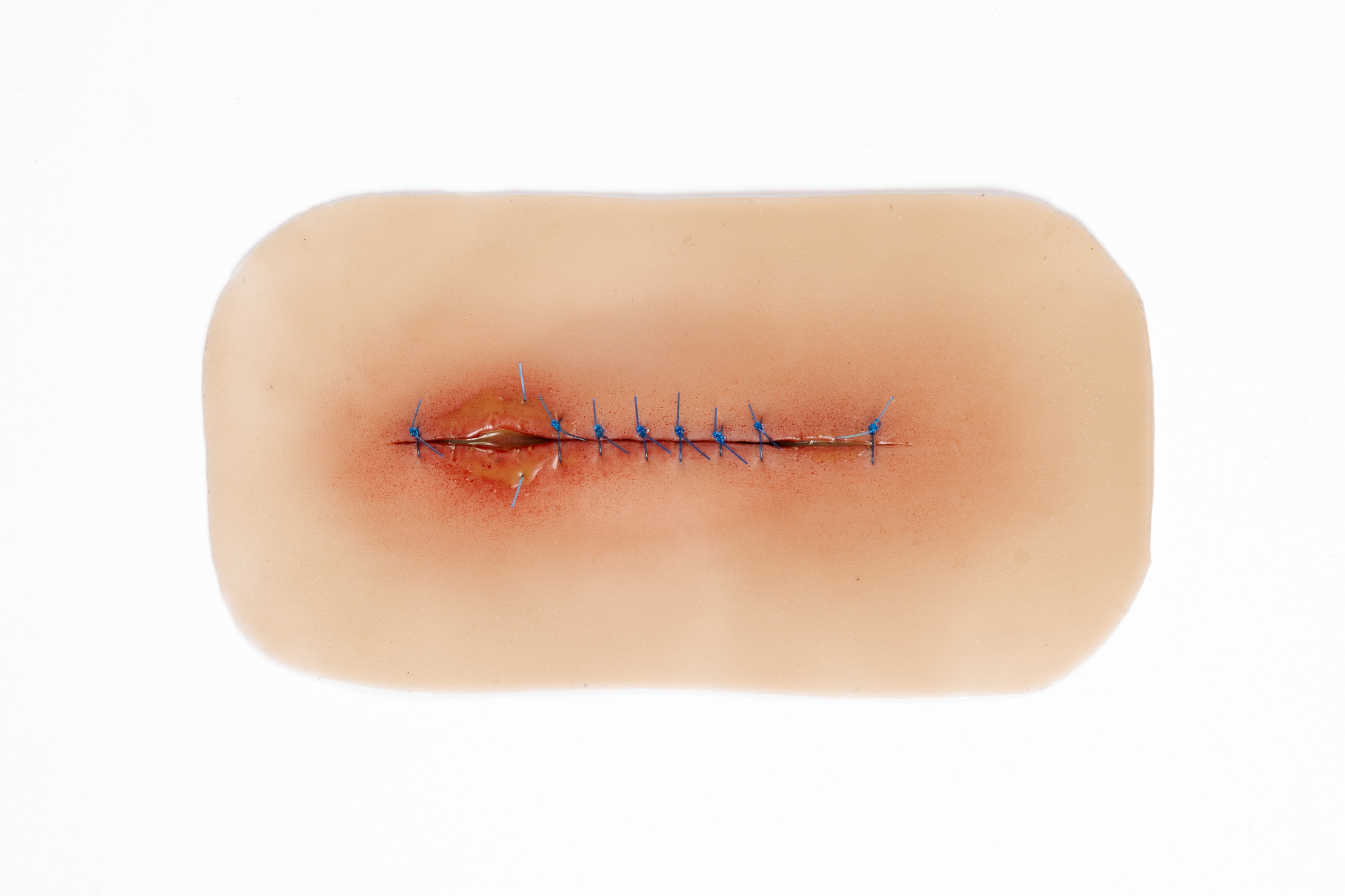 Silicone Wound Kit - Clinical - Image 23