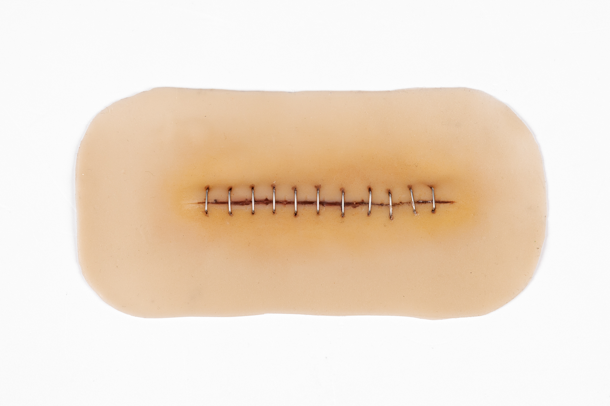 Suture Stapled Healing Small - Image 2