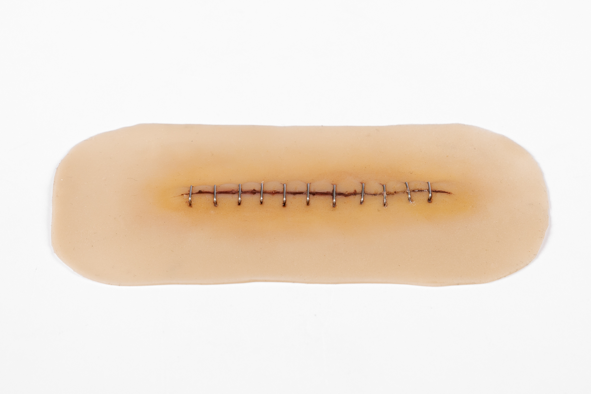 Suture Stapled Healing Small