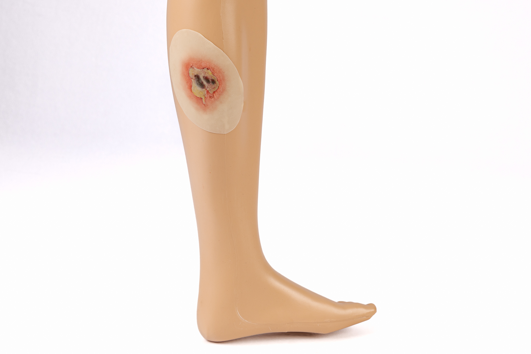 Silicone Wound Kit - Clinical - Image 33