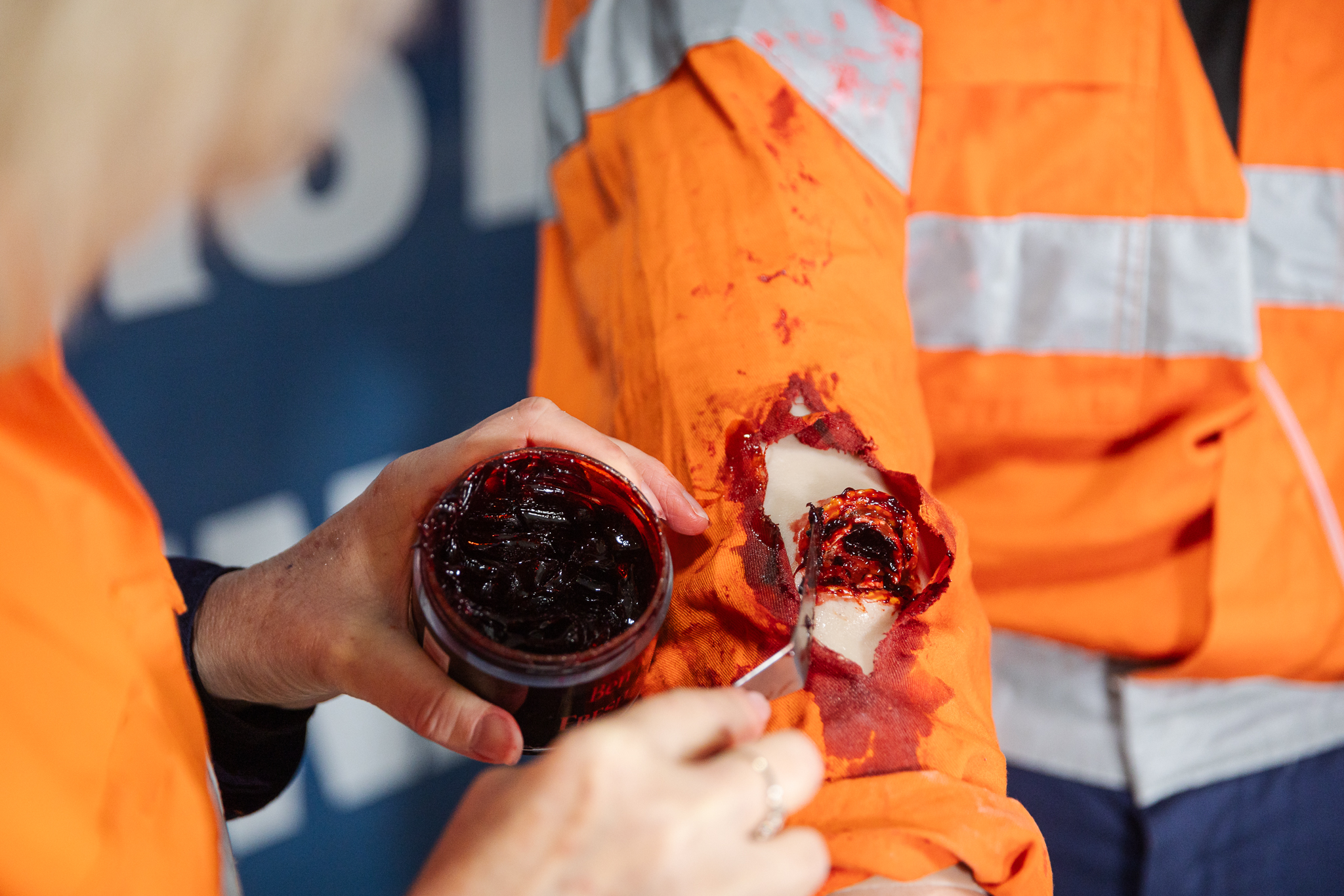 TraumaWear - Open Fracture Forearm with Bleeding capacity - Image 7
