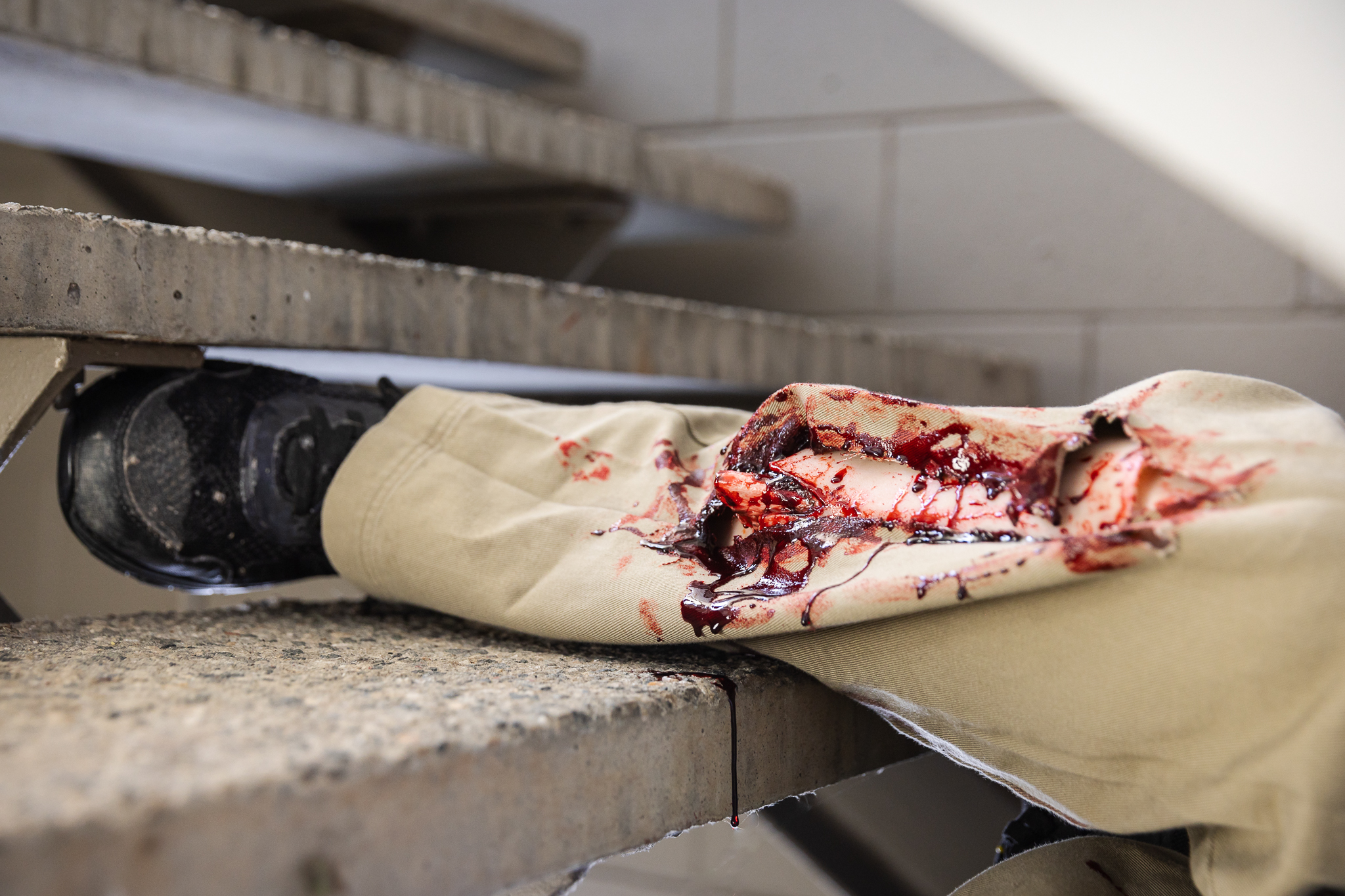 TraumaWear - Open Tibial Fracture Lower Leg with Bleeding Capacity - Image 12