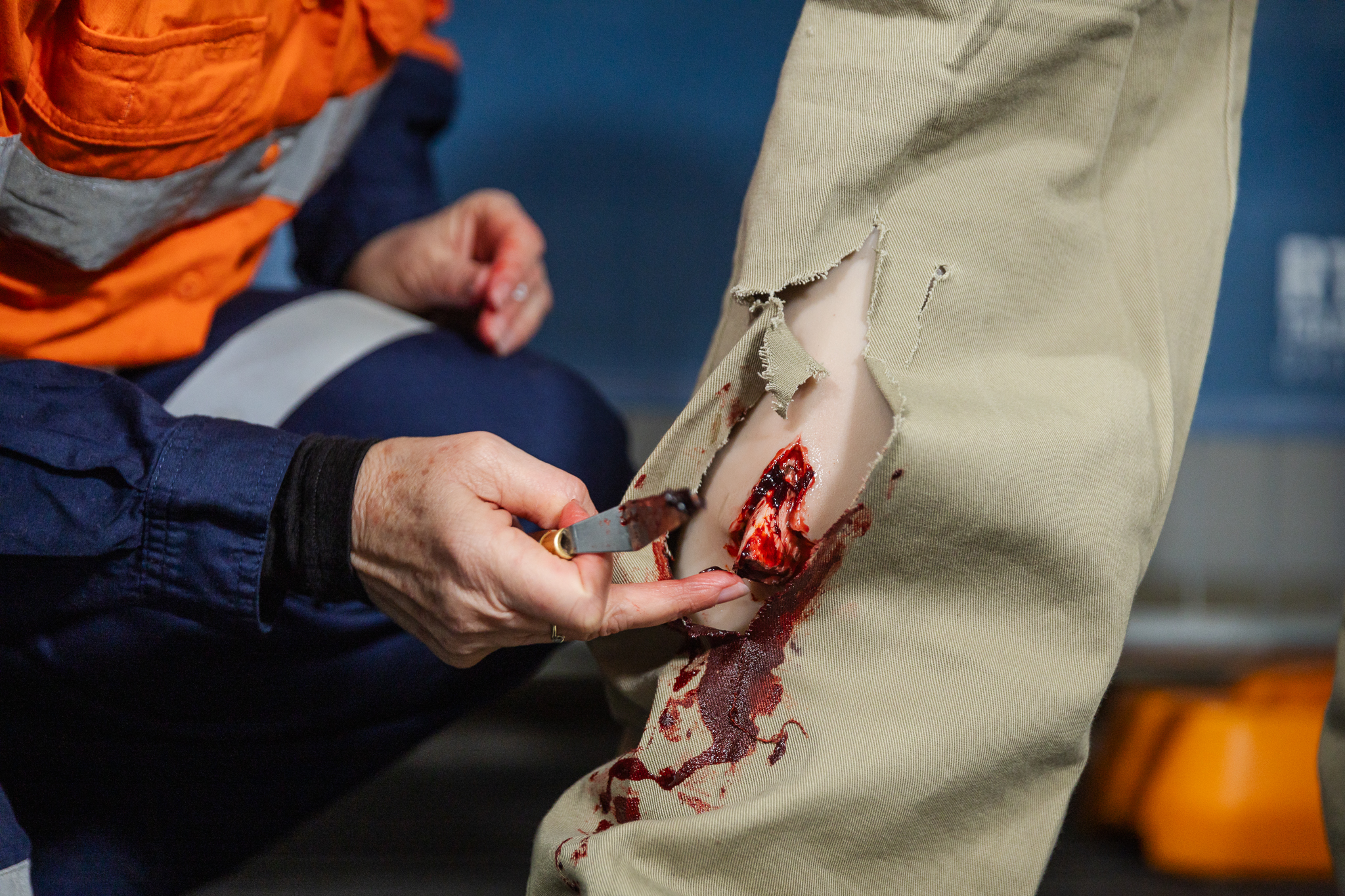 TraumaWear - Open Tibial Fracture Lower Leg - Image 7